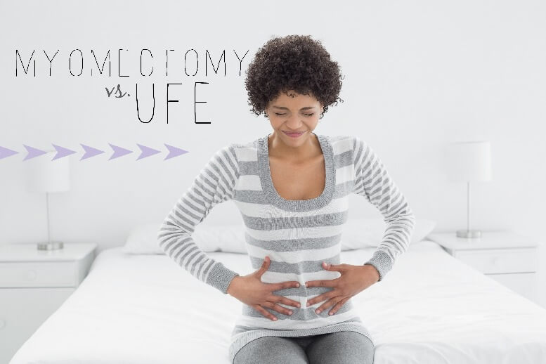 Myomectomy-vs-UFE